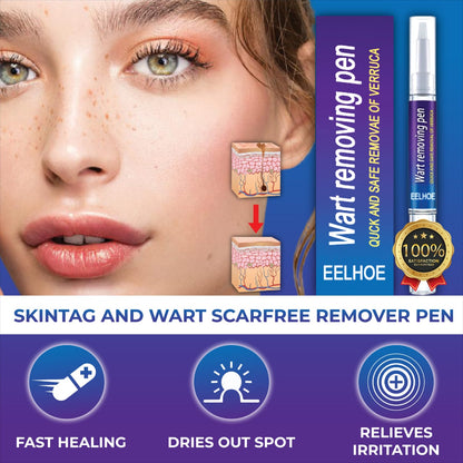 Warts Remover Gel Pen