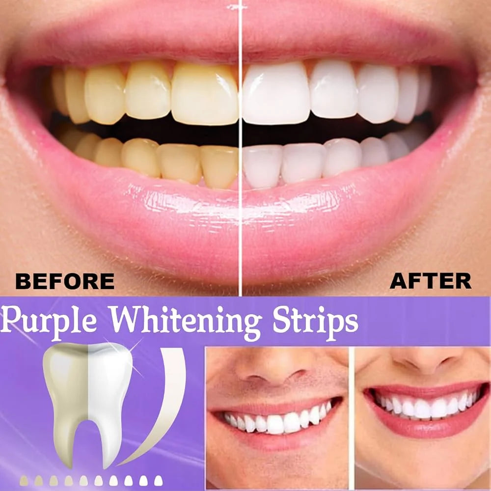 Purple Instant Teeth Whitening Strips