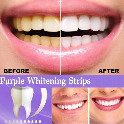 Purple Instant Teeth Whitening Strips